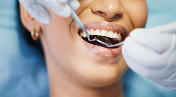 Best Emergency Dentist Near Me  in Resaca, GA